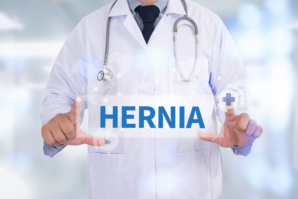 You are currently viewing What is a Hernia?